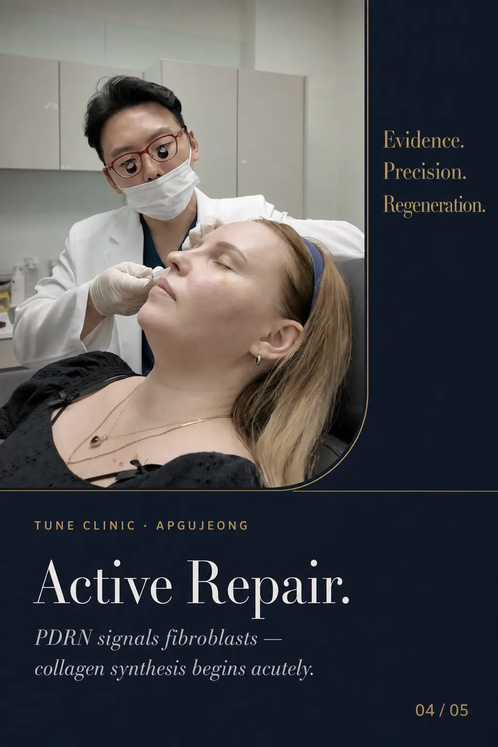 Active Repair. — PDRN signals fibroblasts — collagen synthesis begins acutely.