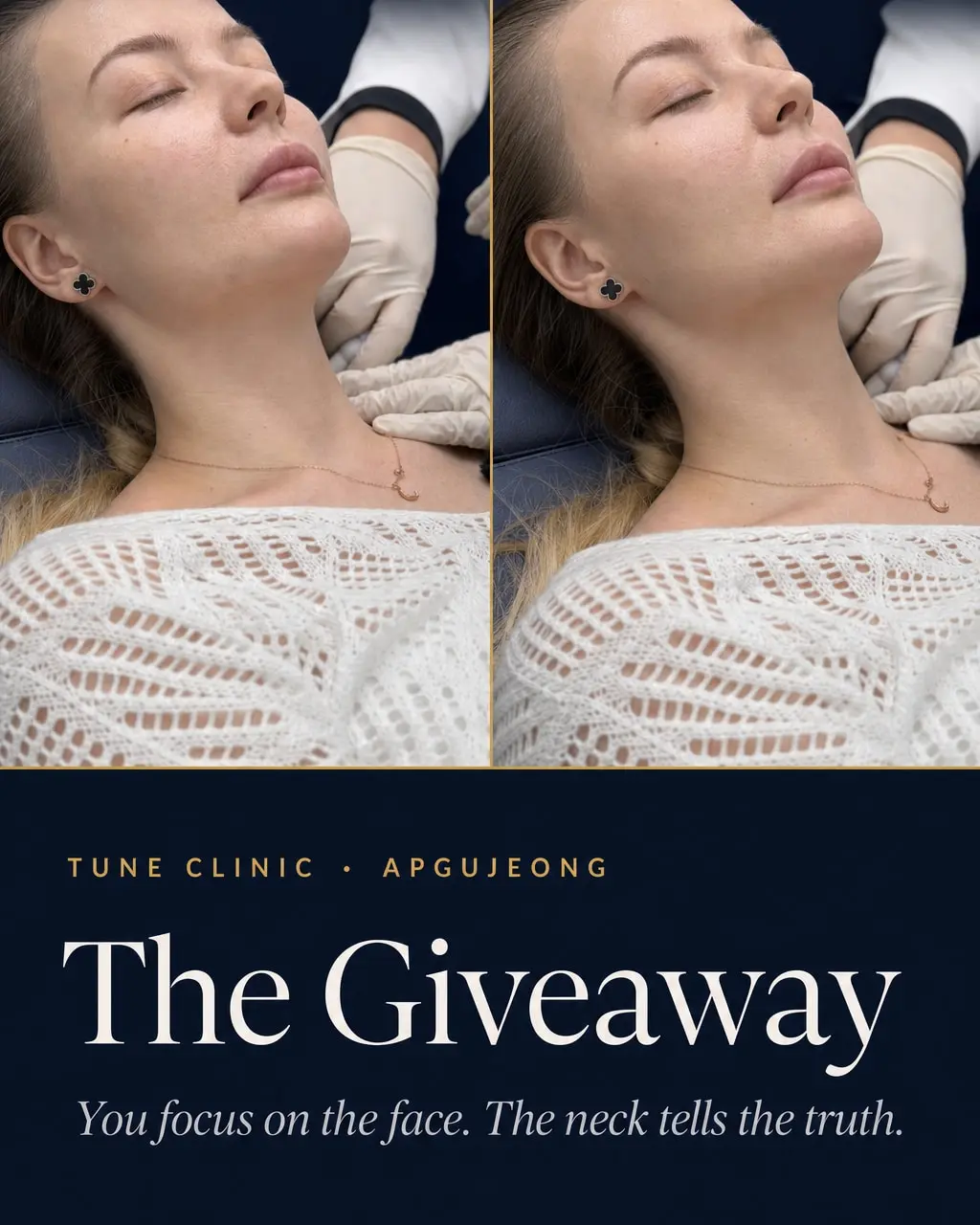 The Giveaway — You focus on the face. The neck tells the truth.