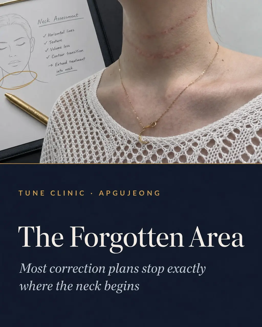 The Forgotten Area — Most correction plans stop exactly where the neck begins