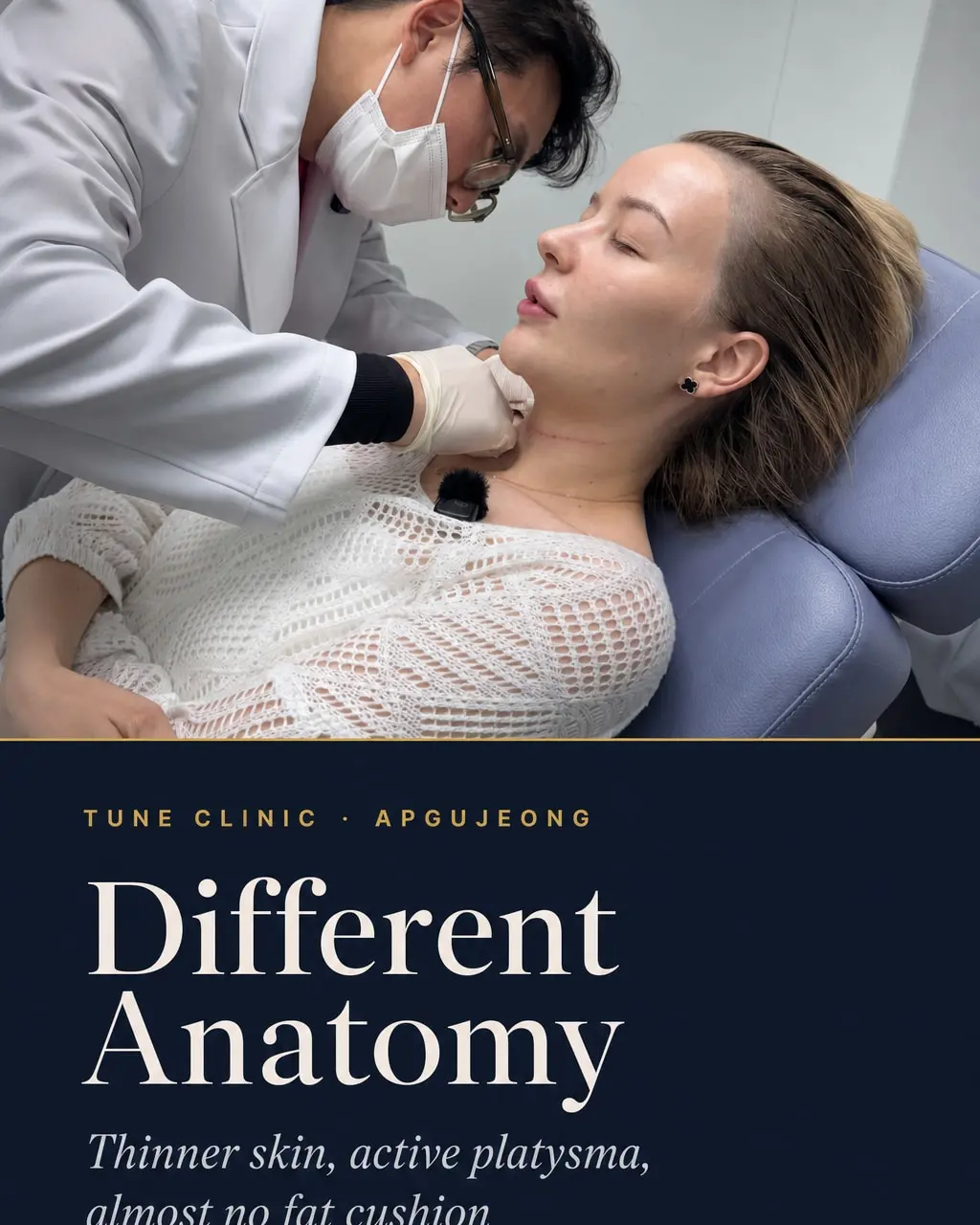 Different Anatomy — Thinner skin, active platysma, almost no fat cushion