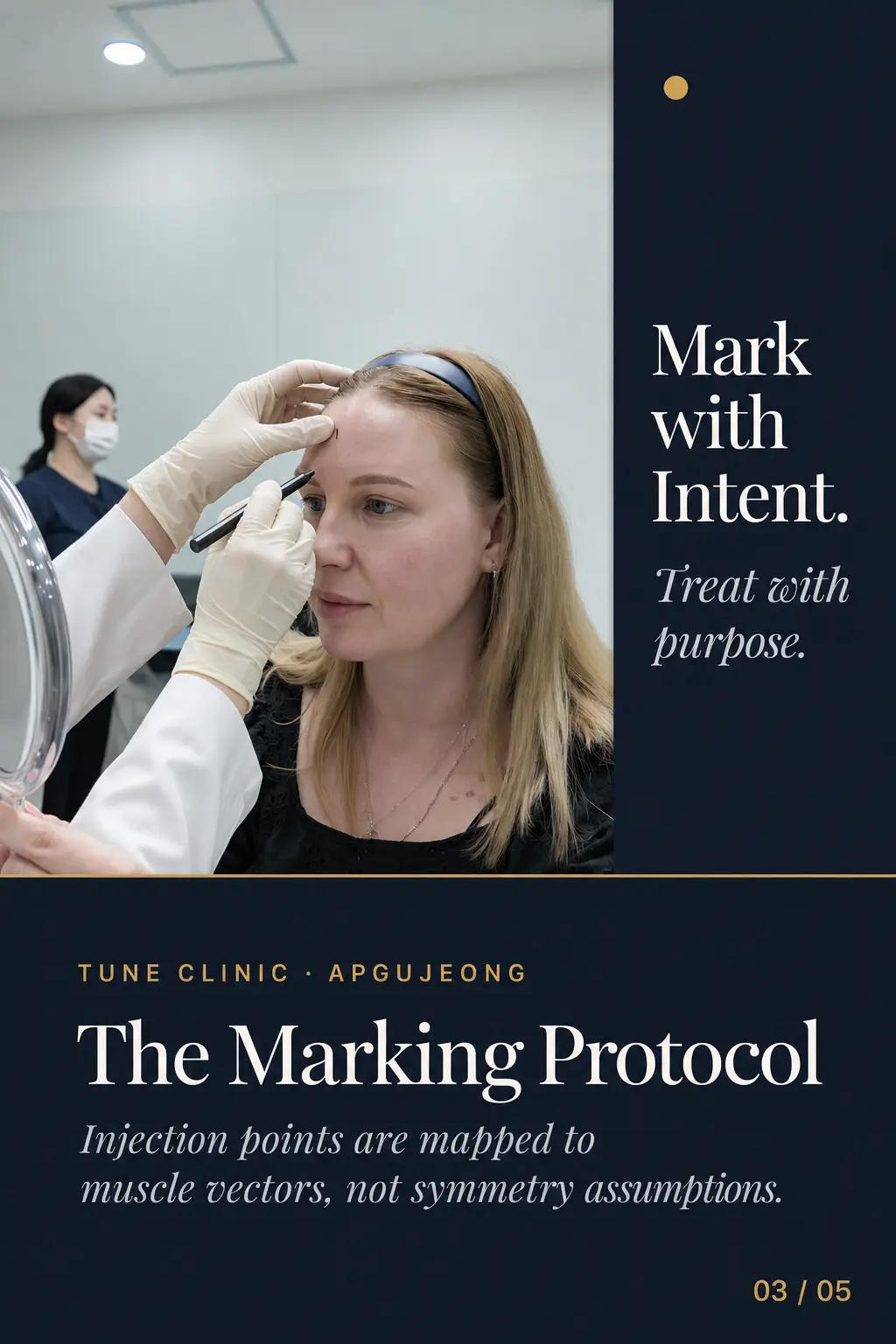 The Marking Protocol — Injection points are mapped to muscle vectors, not symmetry assumptions.