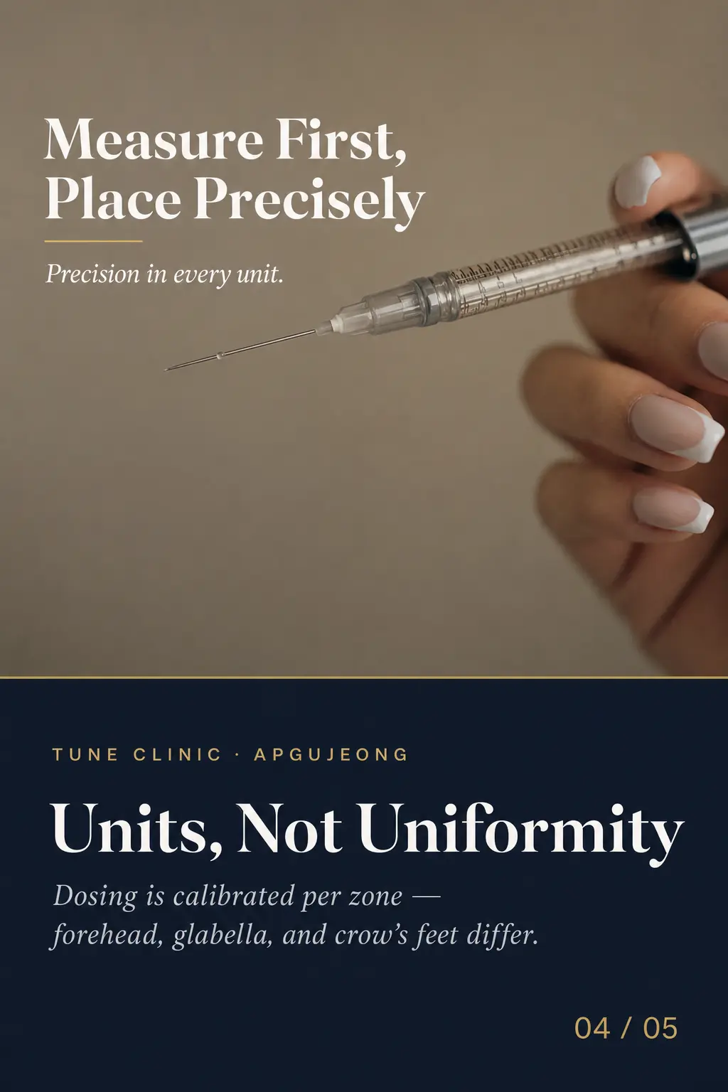 Units, Not Uniformity — Dosing is calibrated per zone — forehead, glabella, and crow's feet differ.