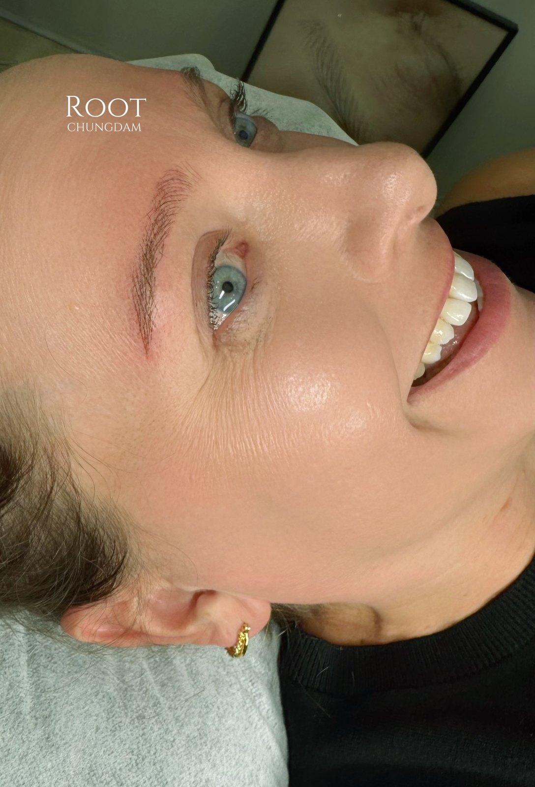 Patient smiling with hair-stroke brows by Root Chungdam
