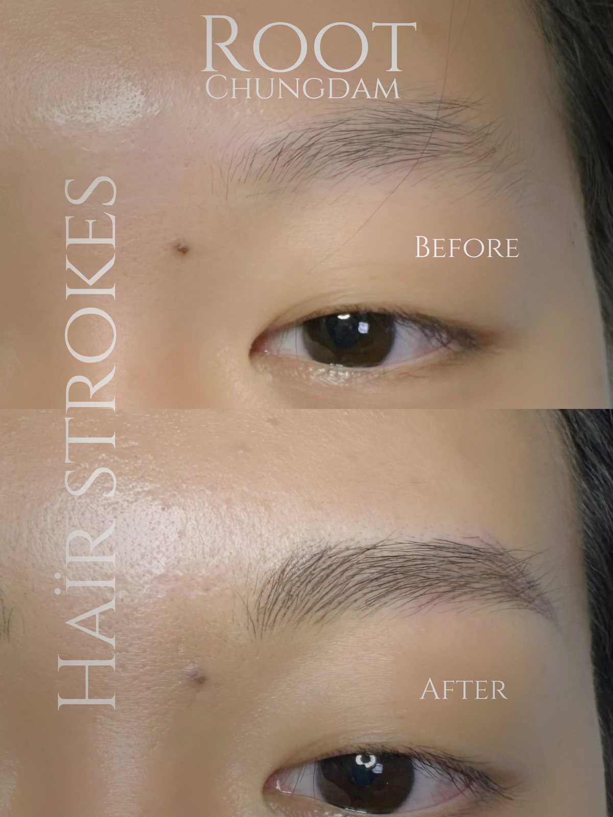 Root Chungdam hair-stroke brow portfolio composite, case 1