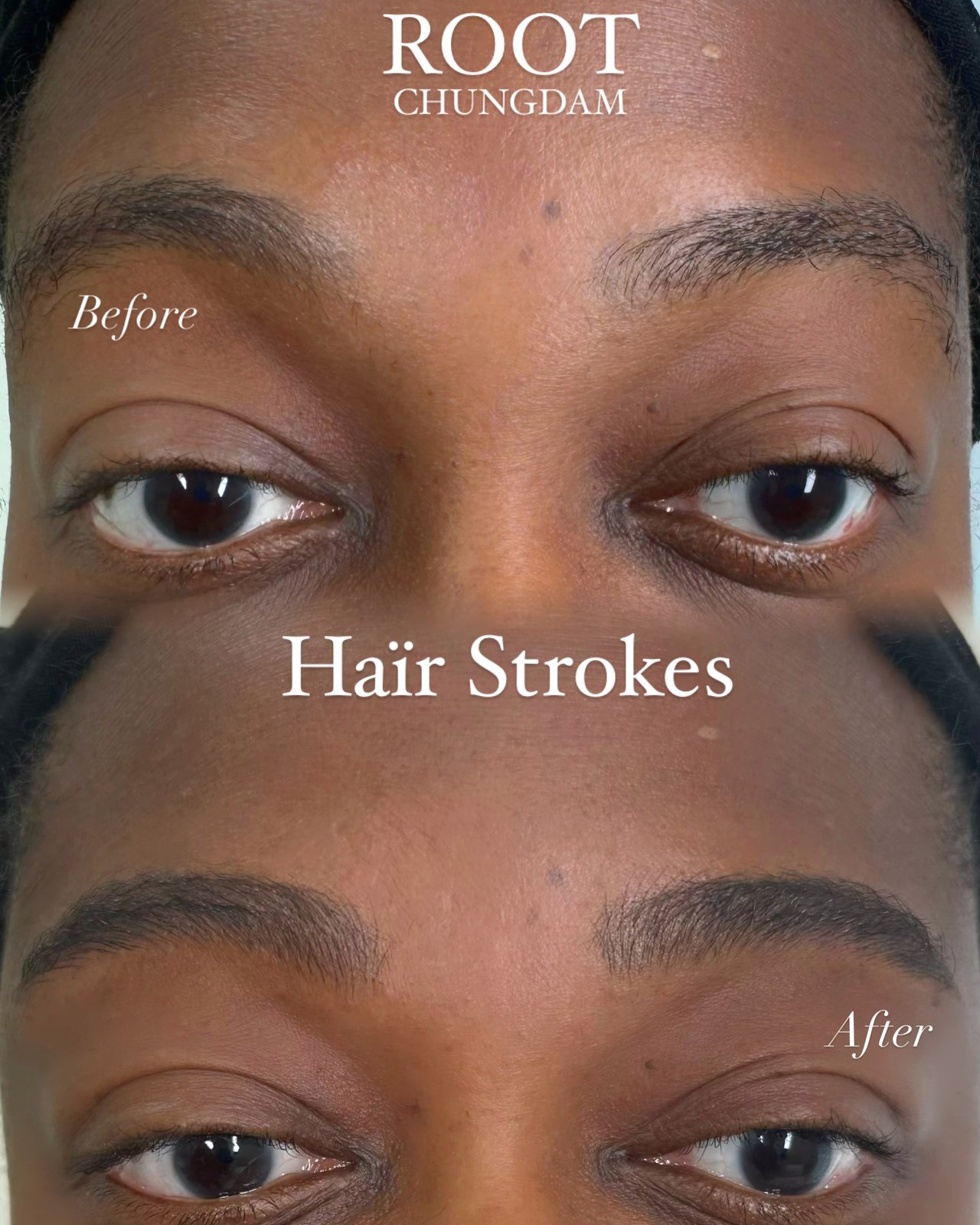 Root Chungdam hair-stroke brow portfolio composite, case 2