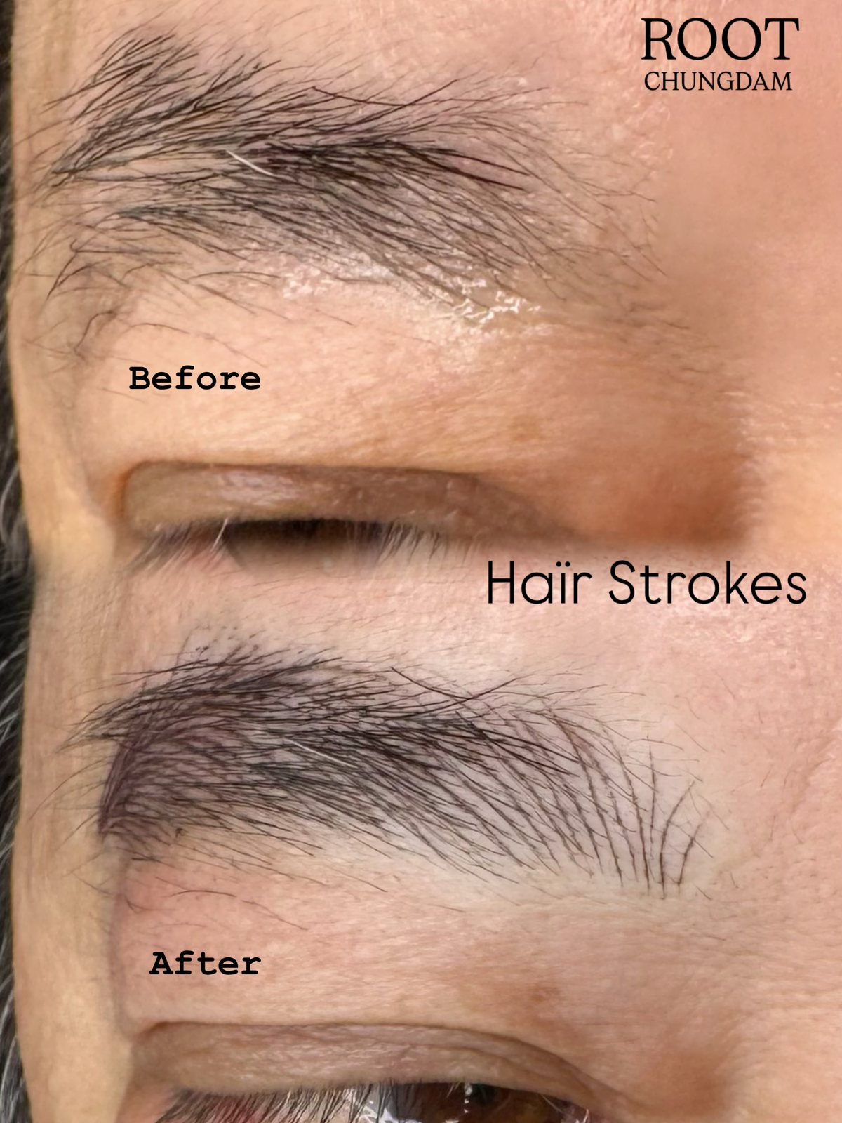 Root Chungdam hair-stroke brow portfolio composite, case 4
