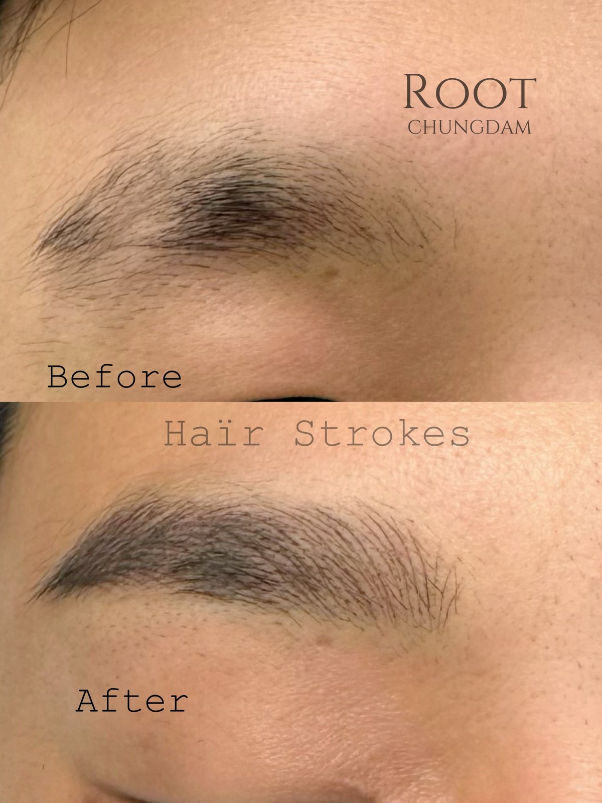 Root Chungdam hair-stroke brow portfolio composite, case 5