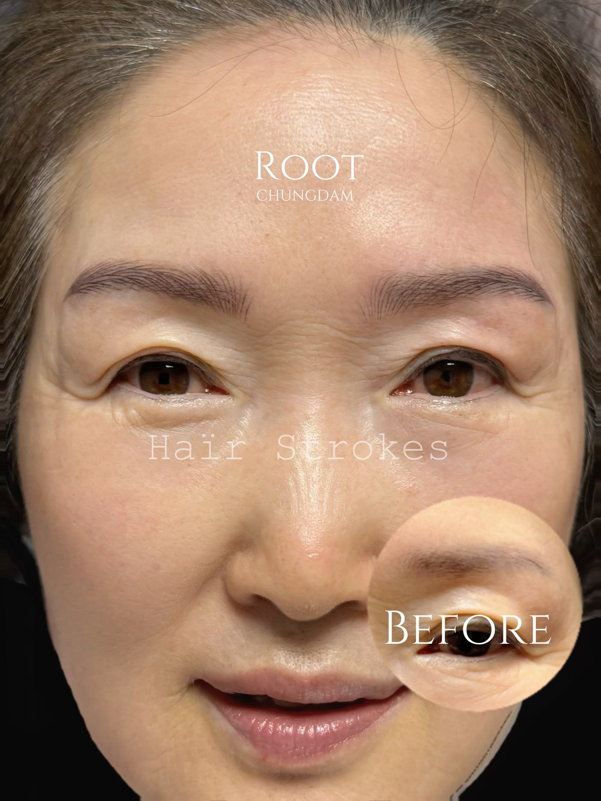 Root Chungdam hair-stroke brow portfolio composite, case 6