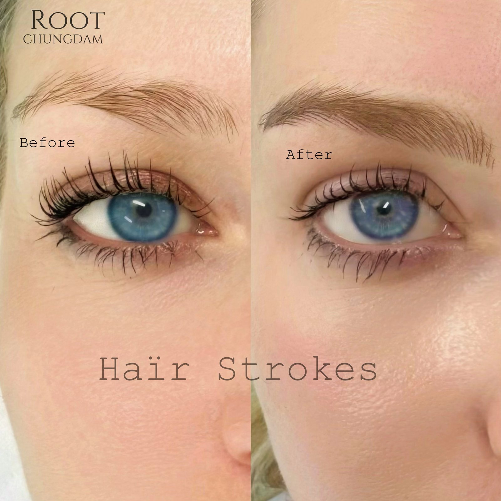 Root Chungdam hair-stroke brow portfolio composite, case 7
