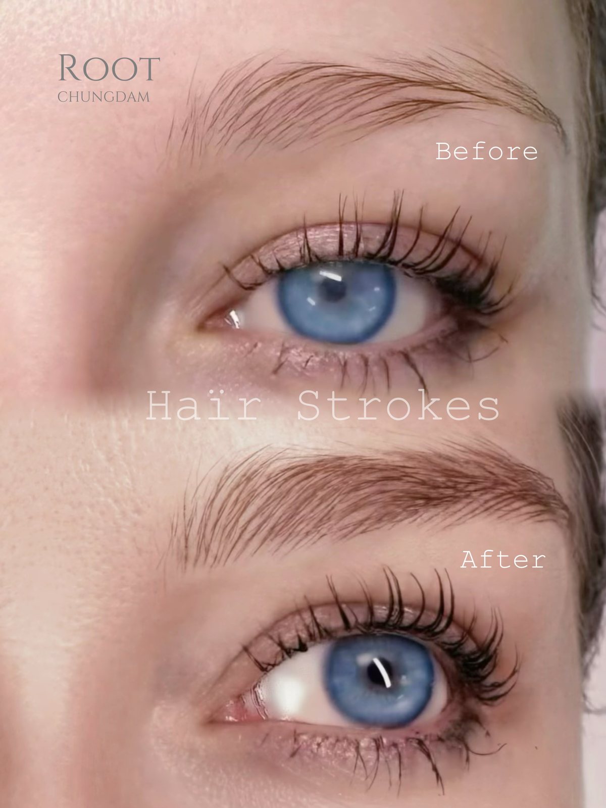 Root Chungdam hair-stroke brow portfolio composite, case 8