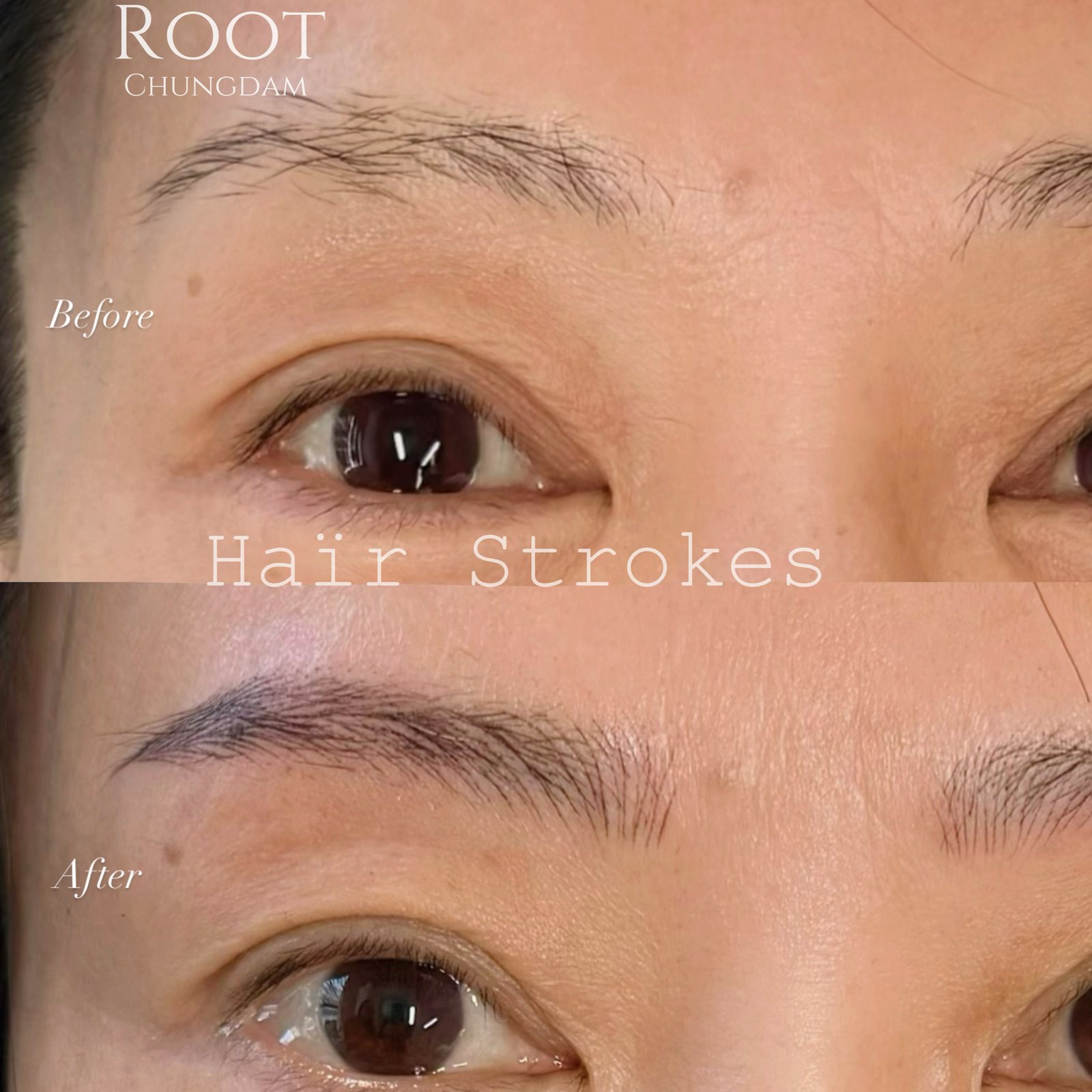 Root Chungdam hair-stroke brow portfolio composite, case 9