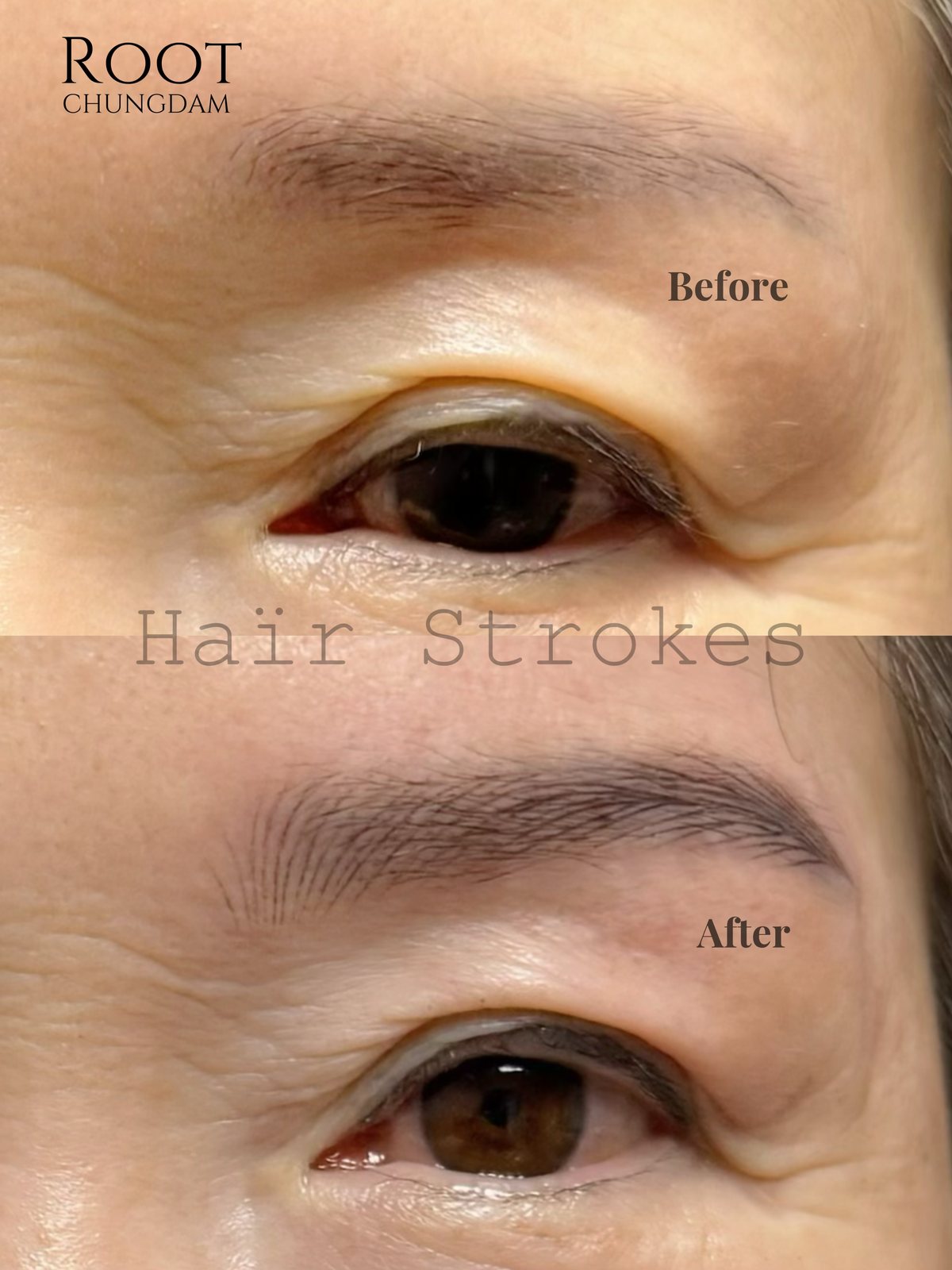 Root Chungdam hair-stroke brow portfolio composite, case 10