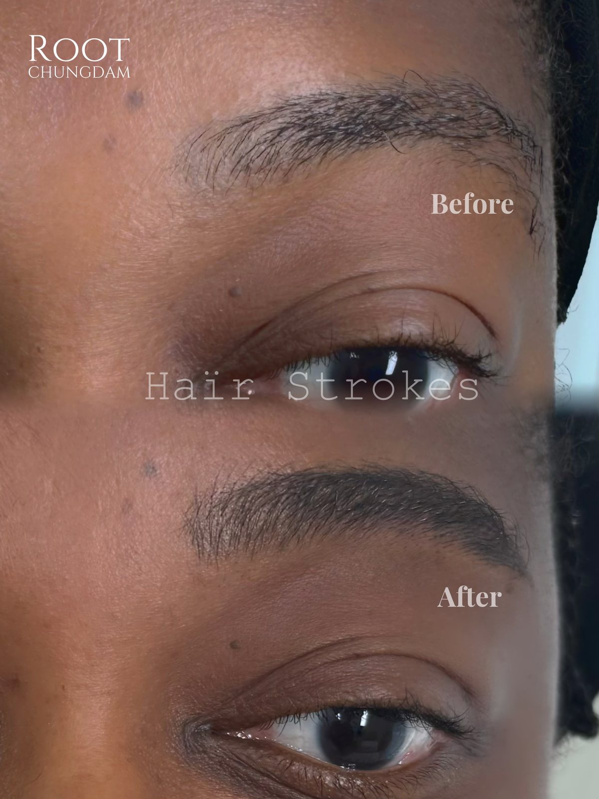 Root Chungdam hair-stroke brow portfolio composite, case 11