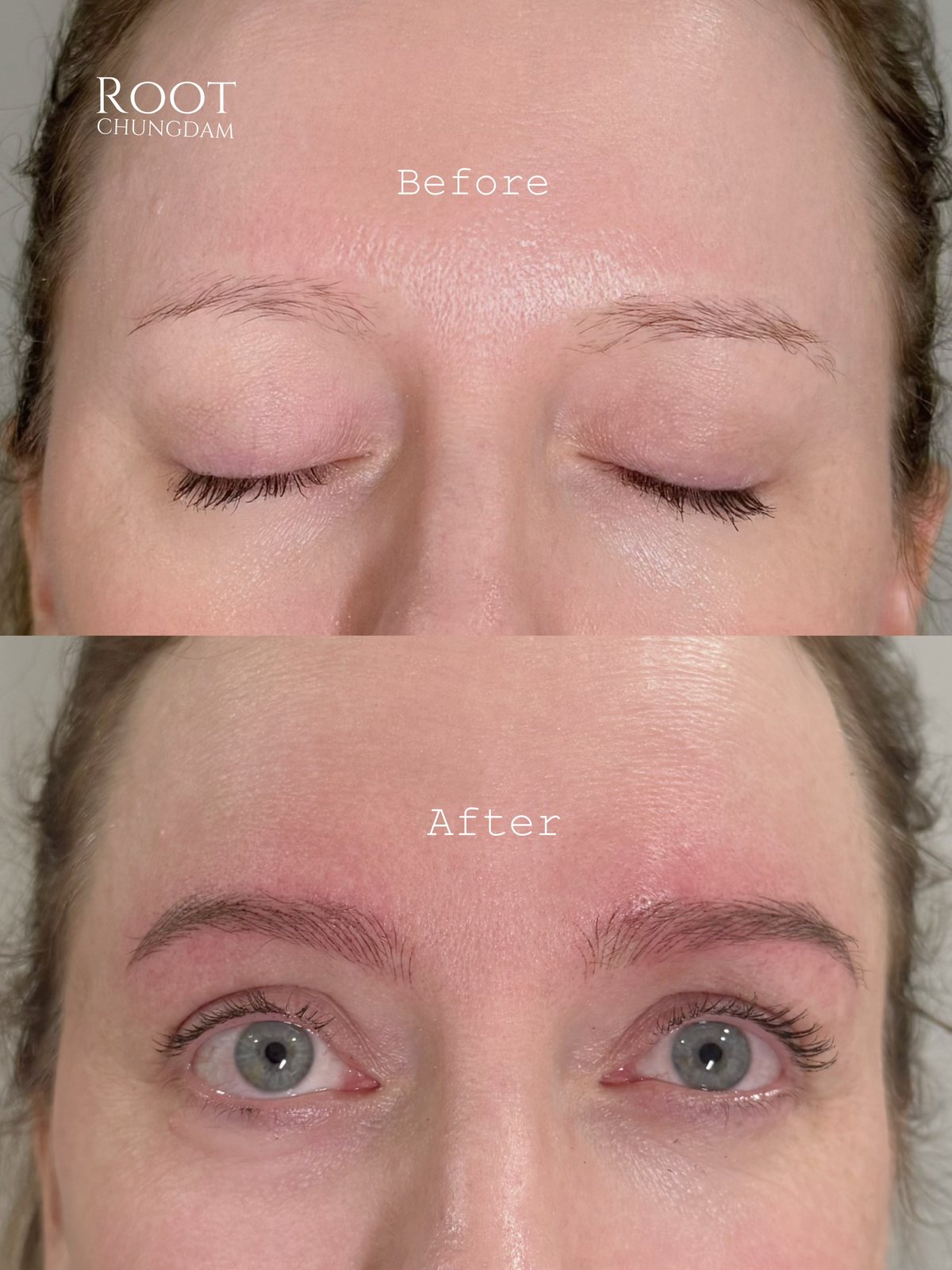 Root Chungdam hair-stroke brow portfolio composite, case 12