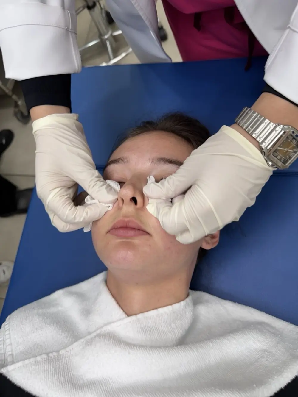Lip filler treatment at Tune Clinic — 1