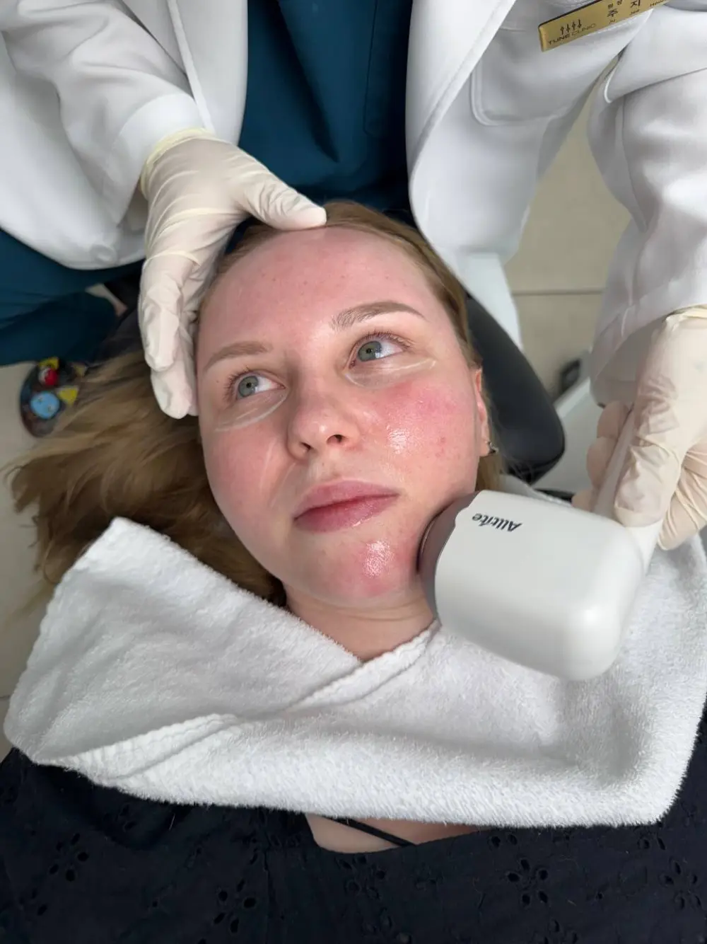 Onda treatment at Tune Clinic — 3