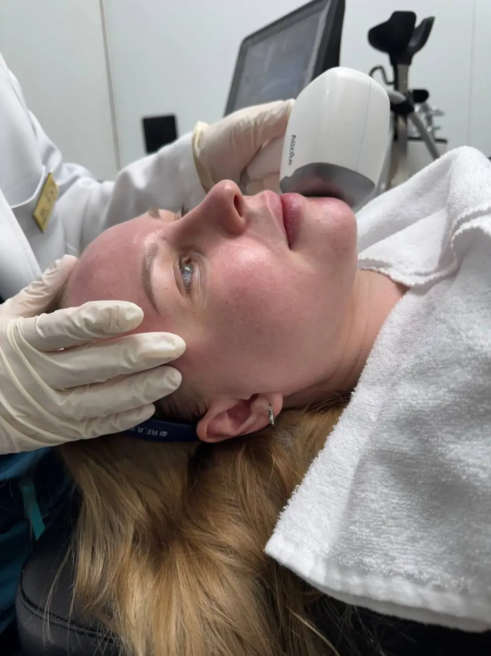 Onda treatment at Tune Clinic — 5