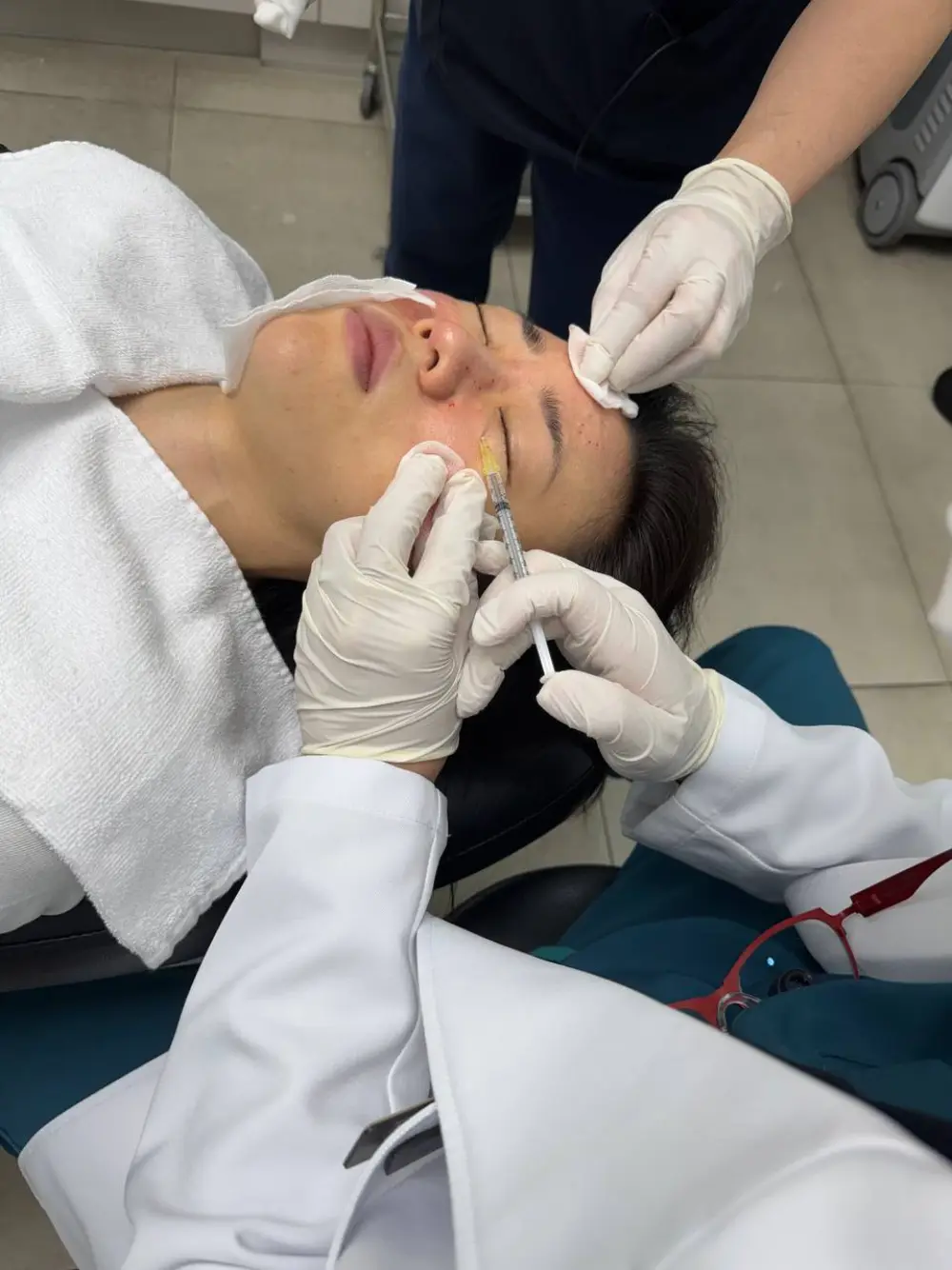 Collagen-stimulator (PLLA) treatment at Tune Clinic — 6