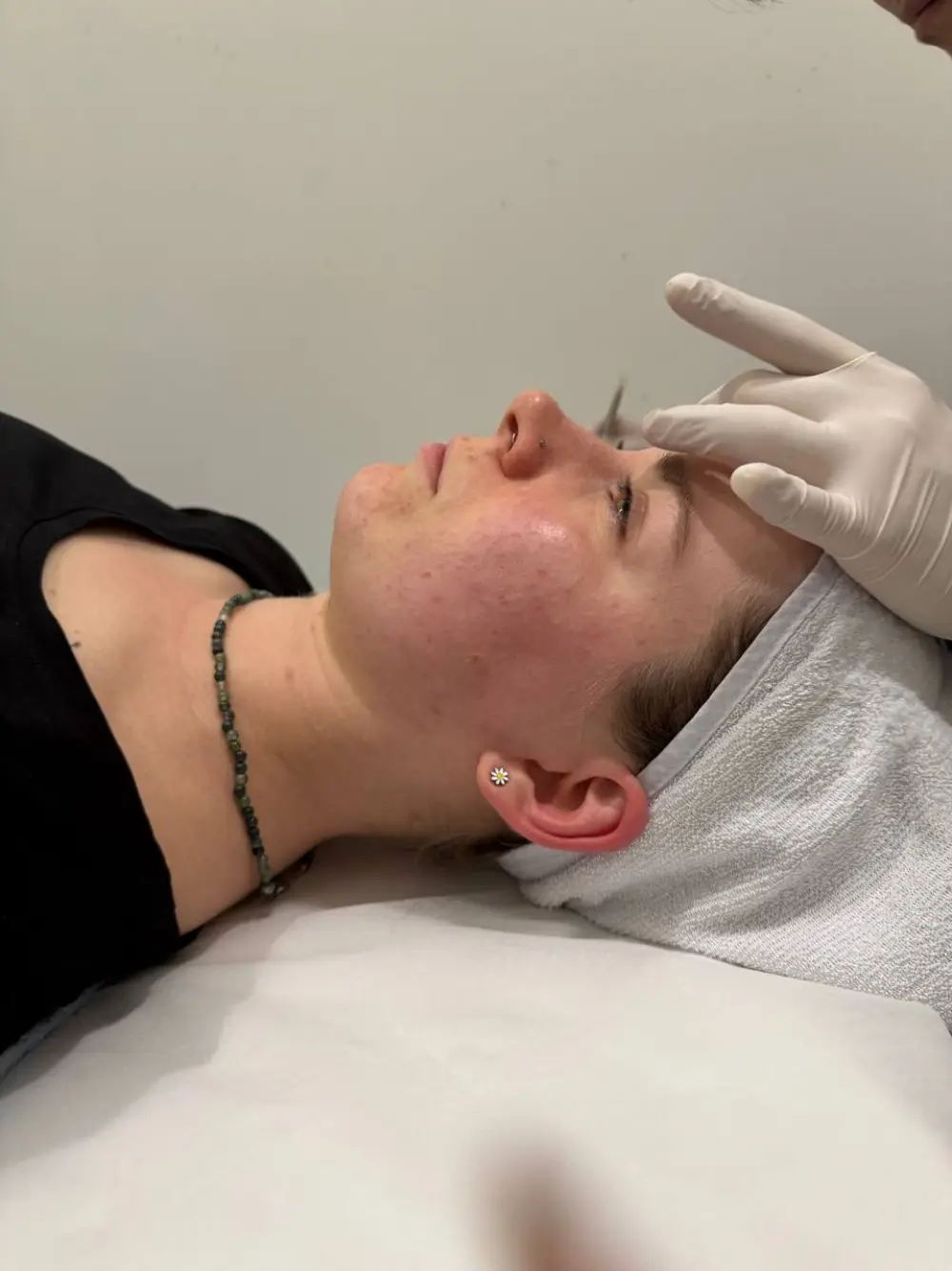Skin care session at Tune Clinic — 7