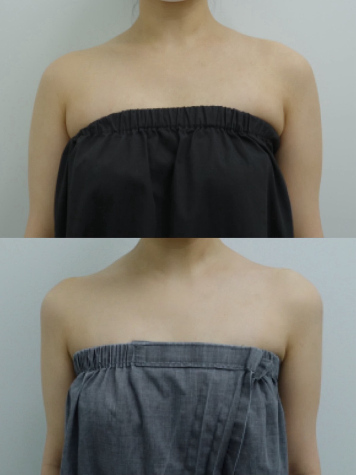 Before and after — Shoulder Line Filler